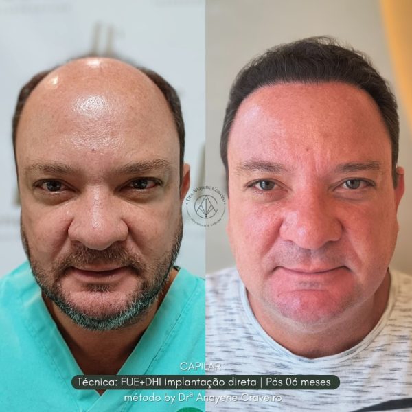 Imagem do WhatsApp de 2025-06-25 à(s) 14.50.20_daa9a32e Imagem do WhatsApp de 2025-06-25 à(s) 14.50.20_daa9a32e